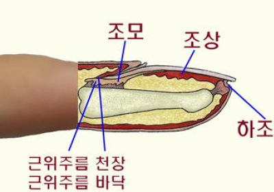 [건강정보] 손발톱 밑 검게 물들면 피부암 의심